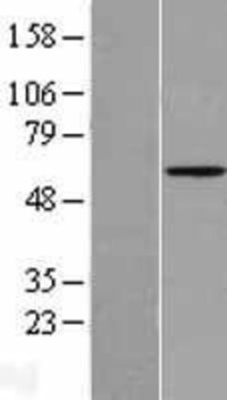 Novus Biologicals&trade;&nbsp;Angiopoietin-2 Overexpression Lysate