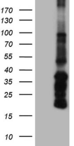 Angiopoietin-1 Antibody (OTI8H2), Novus Biologicals 0.1mL; Unlabeled:Antibodies,