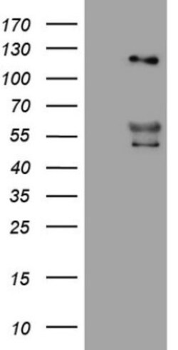 Angiopoietin-2 Antibody (OTI3H7), Novus Biologicals 0.1mL; Unlabeled:Antibodies,