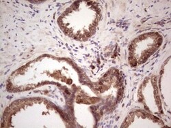 Angiopoietin-2 Antibody (OTI3H7), Novus Biologicals 0.1mL; Unlabeled:Antibodies,