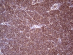 Angiopoietin-2 Antibody (OTI3H7), Novus Biologicals 0.1mL; Unlabeled:Antibodies,