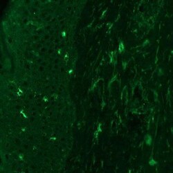 Angiopoietin-2 Antibody (MM0020-1F29) - Azide and BSA Free, Novus Biologicals