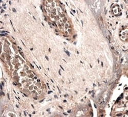 Angiopoietin-2 Antibody (MM0020-1F29) - Azide and BSA Free, Novus Biologicals