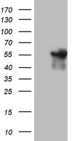 Angiopoietin-like Protein 1/ANGPTL1 Antibody (OTI1B2), Novus Biologicals