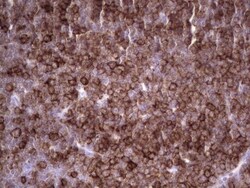 Angiopoietin-like Protein 1/ANGPTL1 Antibody (OTI1B2), Novus Biologicals