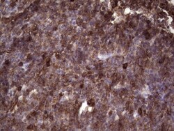 Angiopoietin-like Protein 1/ANGPTL1 Antibody (OTI1B2), Novus Biologicals