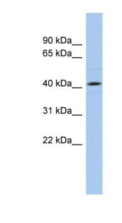 Angiopoietin-like Protein 5/ANGPTL5 Antibody, Novus Biologicals:Antibodies:Primary
