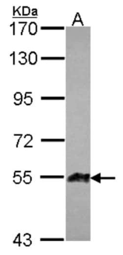 Angiopoietin-like Protein 1/ANGPTL1 Antibody, Novus Biologicals 0.1mL;