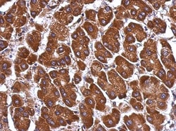 Angiopoietin-like Protein 3/ANGPTL3 Antibody, Novus Biologicals 0.1mL;