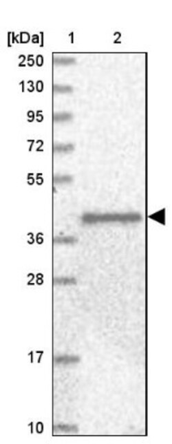 Angiopoietin-like Protein 3/ANGPTL3 Antibody, Novus Biologicals:Antibodies:Primary