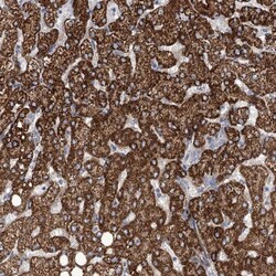 Angiopoietin-like Protein 3/ANGPTL3 Antibody, Novus Biologicals:Antibodies:Primary