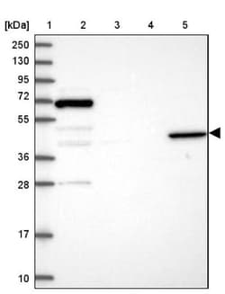 Angiopoietin-like Protein 5/ANGPTL5 Antibody, Novus Biologicals 0.1mL;