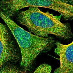 Angiopoietin-like Protein 5/ANGPTL5 Antibody, Novus Biologicals 0.1mL;