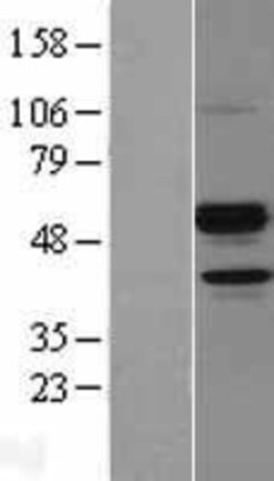 Novus Biologicals&trade;&nbsp;Angiopoietin-like Protein 7/ANGPTL7 Overexpression Lysate