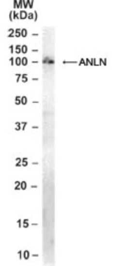 Anillin Antibody, Novus Biologicals 0.1mg; Unlabeled:Antibodies, Polyclonal