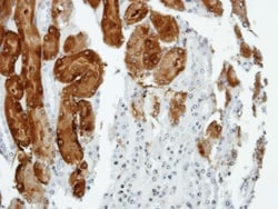 Anillin Antibody, Novus Biologicals 0.1mg; Unlabeled:Antibodies, Polyclonal