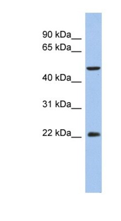 ANKH Antibody, Novus Biologicals 0.05mg; Unlabeled:Antibodies, Polyclonal