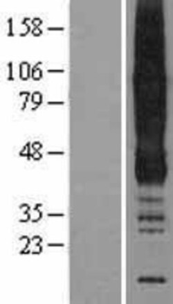 Novus Biologicals&trade;&nbsp;ANKH Overexpression Lysate