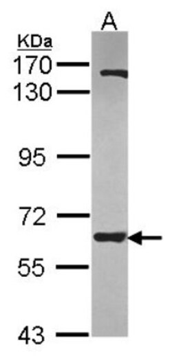ANKHD1 Antibody, Novus Biologicals 0.1mL; Unlabeled:Antibodies, Polyclonal