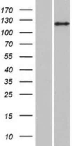 Novus Biologicals&trade;&nbsp;ANKIB1 Overexpression Lysate