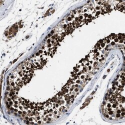 ANKIB1 Antibody, Novus Biologicals:Antibodies:Primary Antibodies