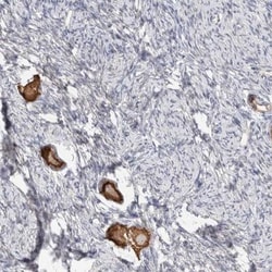 ANKMY1 Antibody, Novus Biologicals 0.1mL; Unlabeled:Antibodies, Polyclonal