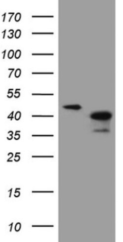 ANKRA2 Antibody (OTI8A9), Novus Biologicals 0.1mL; Unlabeled:Antibodies,