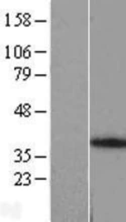 Novus Biologicals&trade;&nbsp;ANKRA2 Overexpression Lysate