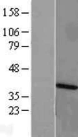 Novus Biologicals&trade;&nbsp;ANKRD1 Overexpression Lysate