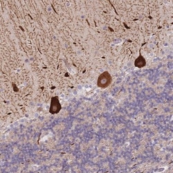 ANKRD10 Antibody, Novus Biologicals:Antibodies:Primary Antibodies