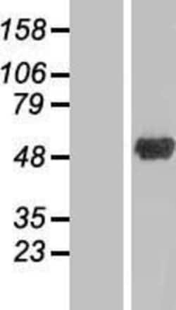 Novus Biologicals&trade;&nbsp;ANKRD10 Overexpression Lysate