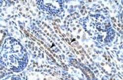 ANKRD11 Antibody, Novus Biologicals 0.1mg; Unlabeled:Antibodies, Polyclonal