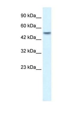 ANKRD11 Antibody, Novus Biologicals 0.1mg; Unlabeled:Antibodies, Polyclonal