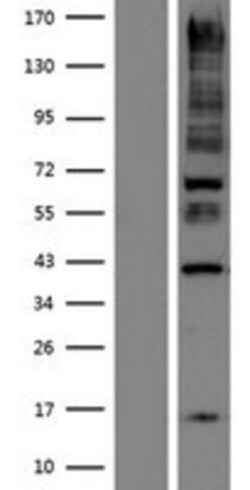 Novus Biologicals&trade;&nbsp;ANKRD15 Overexpression Lysate