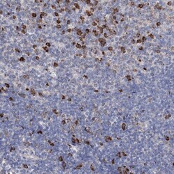 ANKRD16 Antibody, Novus Biologicals:Antibodies:Primary Antibodies