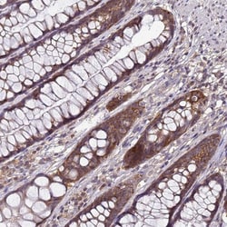 ANKRD17 Antibody, Novus Biologicals 0.1mL; Unlabeled:Antibodies, Polyclonal