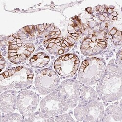 ANKRD20A4 Antibody, Novus Biologicals 25 &mu;L, Unlabeled:Antibodies, Polyclonal