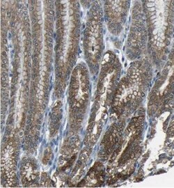 ANKRD22 Antibody, Novus Biologicals 25 &mu;L; Unlabeled:Antibodies, Polyclonal