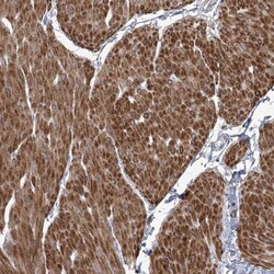 ANKRD23 Antibody, Novus Biologicals:Antibodies:Primary Antibodies