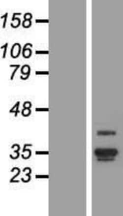 Novus Biologicals&trade;&nbsp;ANKRD29 Overexpression Lysate