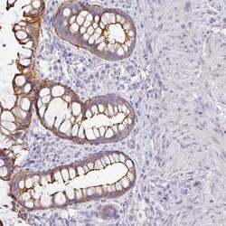 ANKRD29 Antibody, Novus Biologicals 0.1mL; Unlabeled:Antibodies, Polyclonal
