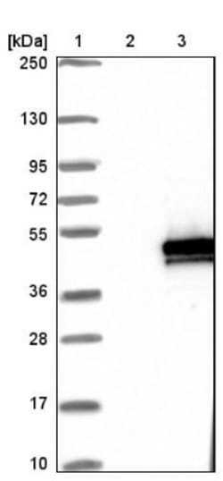 ANKRD2 Antibody, Novus Biologicals 0.1mL; Unlabeled:Antibodies, Polyclonal