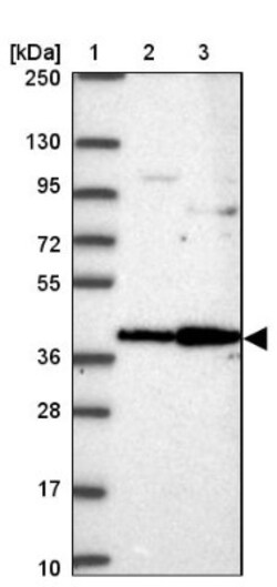ANKRD33 Antibody, Novus Biologicals 0.1mL; Unlabeled:Antibodies, Polyclonal
