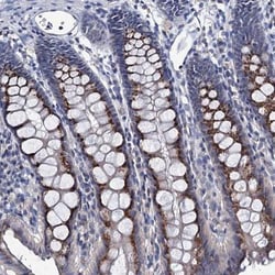 ANKRD33 Antibody, Novus Biologicals 0.1mL; Unlabeled:Antibodies, Polyclonal