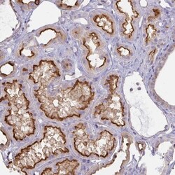ANKRD33 Antibody, Novus Biologicals 0.1mL; Unlabeled:Antibodies, Polyclonal