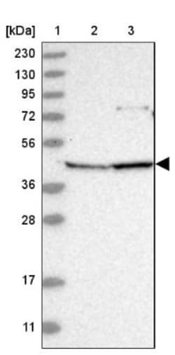 ANKRD34A Antibody, Novus Biologicals:Antibodies:Primary Antibodies