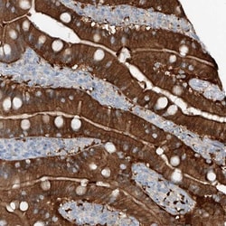 ANKRD34A Antibody, Novus Biologicals:Antibodies:Primary Antibodies