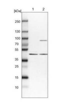 ANKRD34A Antibody, Novus Biologicals:Antibodies:Primary Antibodies