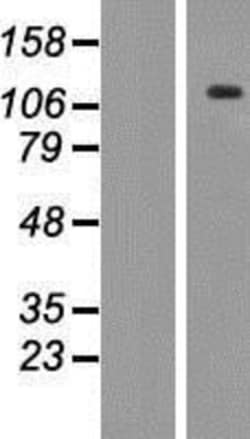 Novus Biologicals™ ANKRD35 Overexpression Lysate