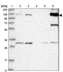 ANKRD35 Antibody, Novus Biologicals 25 μL, Unlabeled:Antibodies, Polyclonal